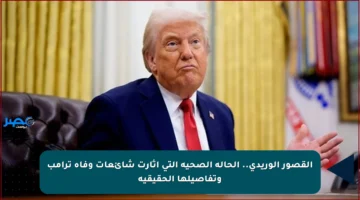 القصور الوريدي.. الحالة الصحية التي أثارت شائعات وفاة ترامب وتفاصيلها الحقيقية